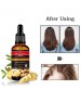Pretty Cowry Ginger Hair Essential Oil Anti Hair Loss Repair Heat Damaged Hair 50ml